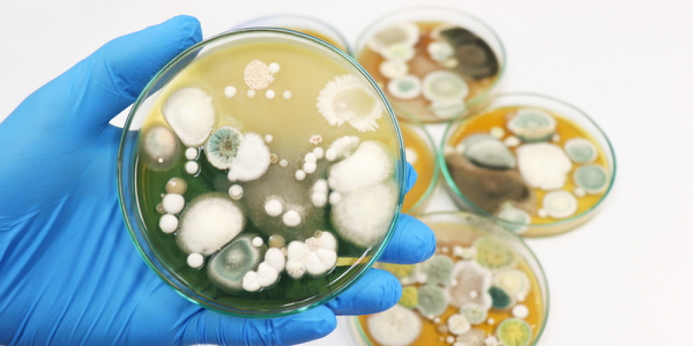 New rapid method for the determination of yeasts and molds in cosmetics in just 3 days New rapid method for the determination of yeasts and molds in cosmetics in just 3 days