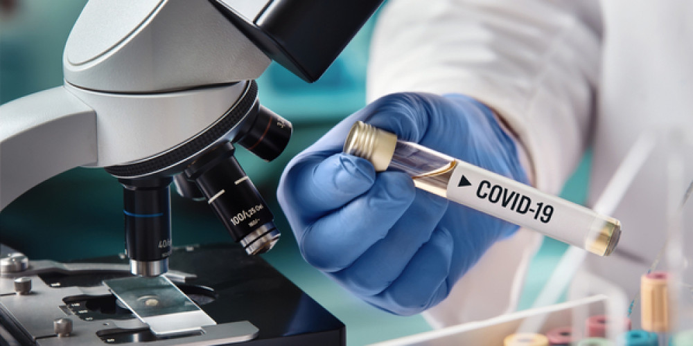 Corona tests for meat companies in Baden-Württemberg no longer mandatory Corona tests for meat companies in Baden-Württemberg no longer mandatory